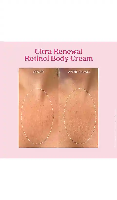 Kopari Ultra Renewal Retinol Body Cream in Beauty: NA.